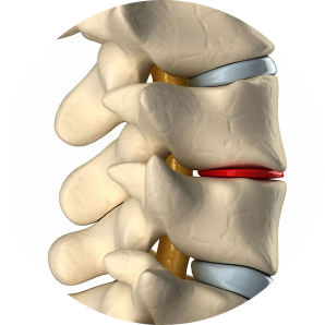 Spinal Decompression Austin | Absolute Life Wellness Center